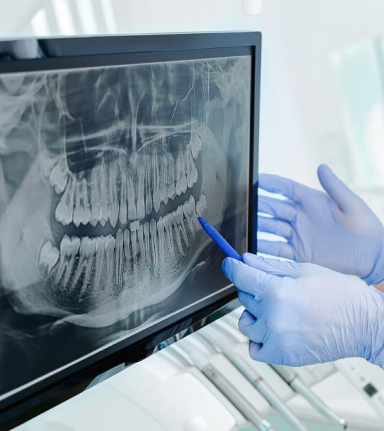 New York Dental Malpractice - Dentist